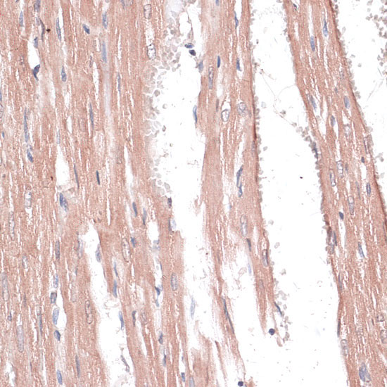 COL11A1 Rabbit Polyclonal Antibody - Image 2