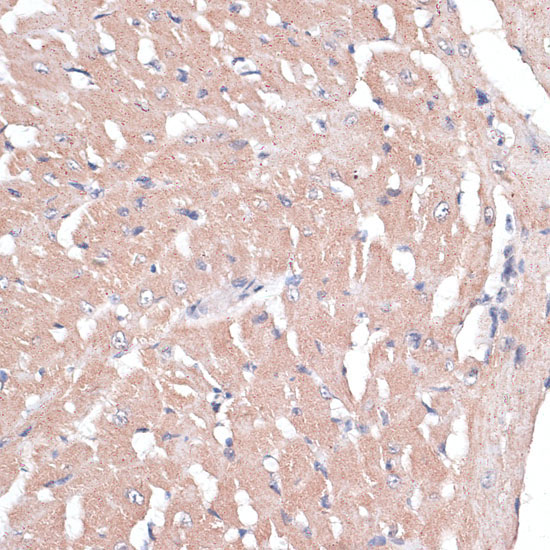 COL11A1 Rabbit Polyclonal Antibody - Image 3