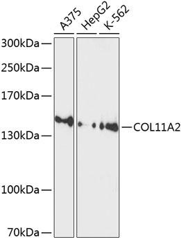COL11A2 Rabbit Polyclonal Antibody