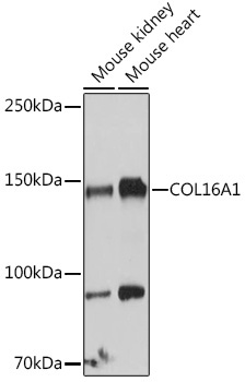 COL16A1 Rabbit Polyclonal Antibody - Image 2