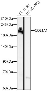 COL1A1 Rabbit Polyclonal Antibody