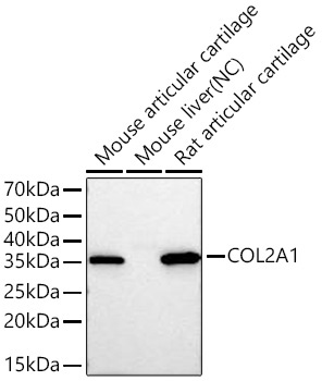 COL2A1 Rabbit Polyclonal Antibody