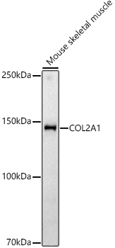 COL2A1 Rabbit Polyclonal Antibody