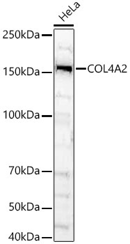 COL4A2 Rabbit Polyclonal Antibody