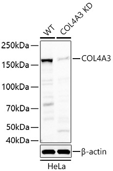 COL4A3 Rabbit Polyclonal Antibody