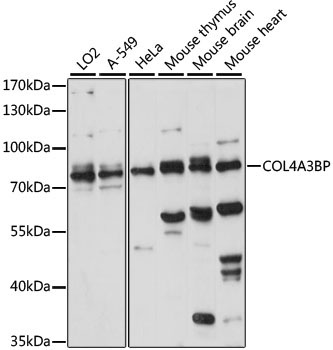 COL4A3BP Rabbit Polyclonal Antibody
