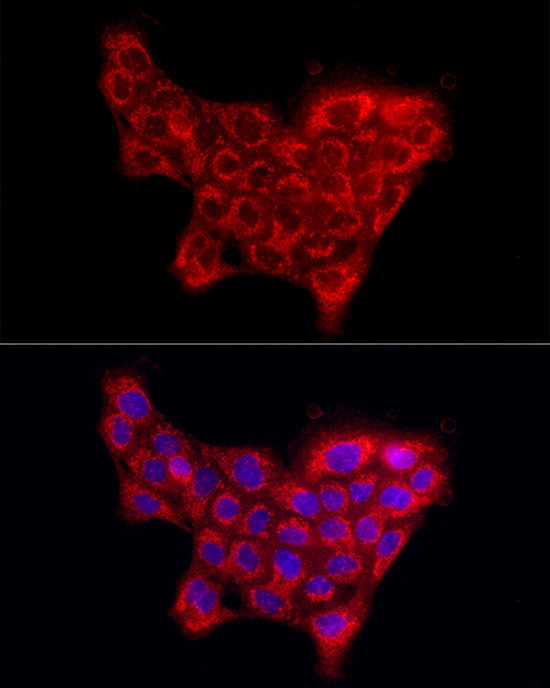 COL4A5 Rabbit Polyclonal Antibody - Image 2