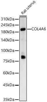 COL4A6 Rabbit Polyclonal Antibody