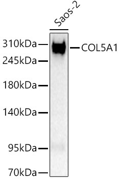 COL5A1 Rabbit Polyclonal Antibody
