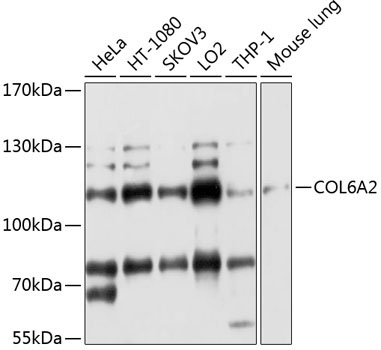 COL6A2 Rabbit Polyclonal Antibody