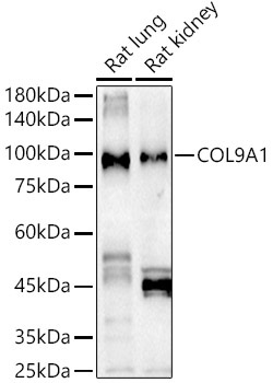 COL9A1 Rabbit Polyclonal Antibody