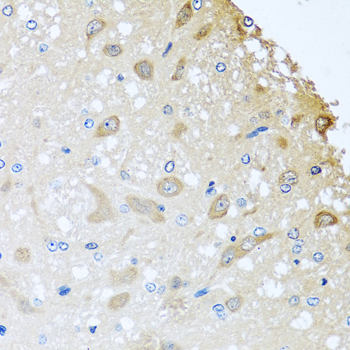 COLEC11 Rabbit Polyclonal Antibody - Image 2