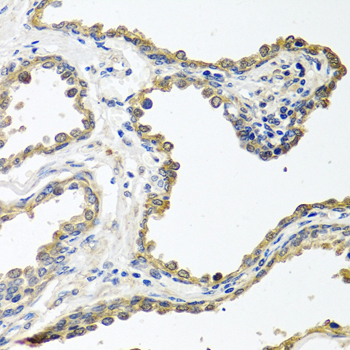 COLEC11 Rabbit Polyclonal Antibody - Image 3