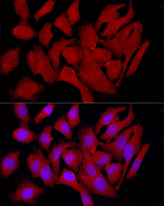 COLGALT1 Rabbit Polyclonal Antibody - Image 2