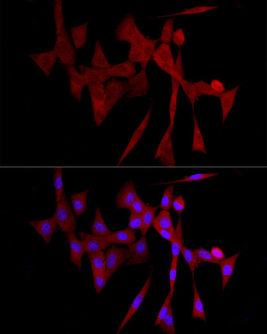 COLGALT1 Rabbit Polyclonal Antibody - Image 3