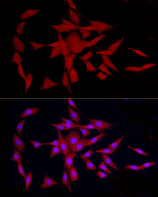 COLGALT1 Rabbit Polyclonal Antibody - Image 4