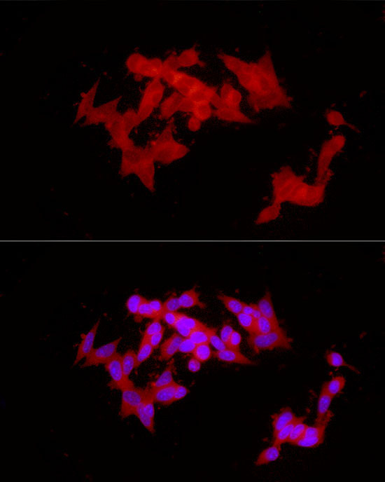 COLGALT1 Rabbit Polyclonal Antibody - Image 5