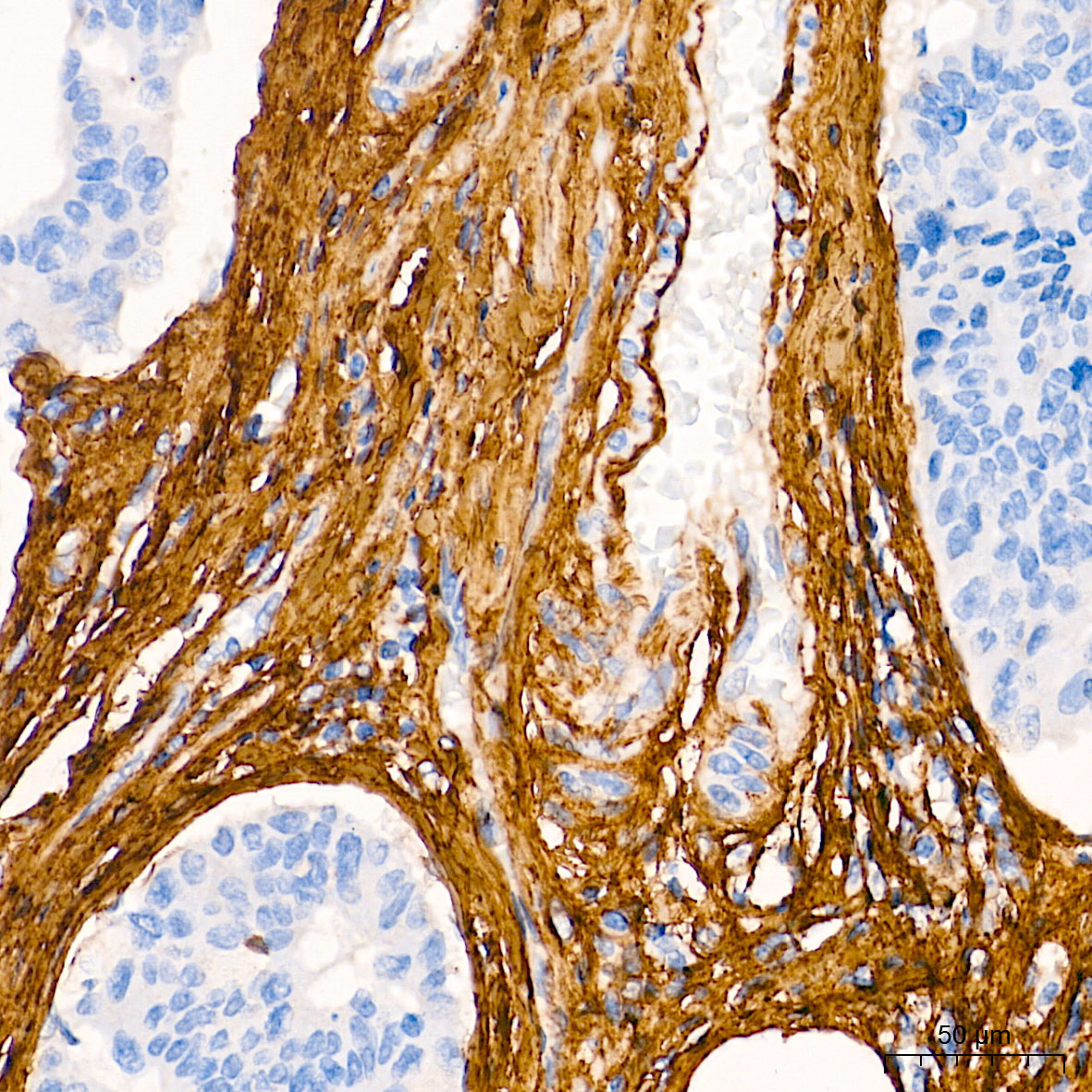 Collagen I/COL1A1 Rabbit Polyclonal Antibody - Image 2
