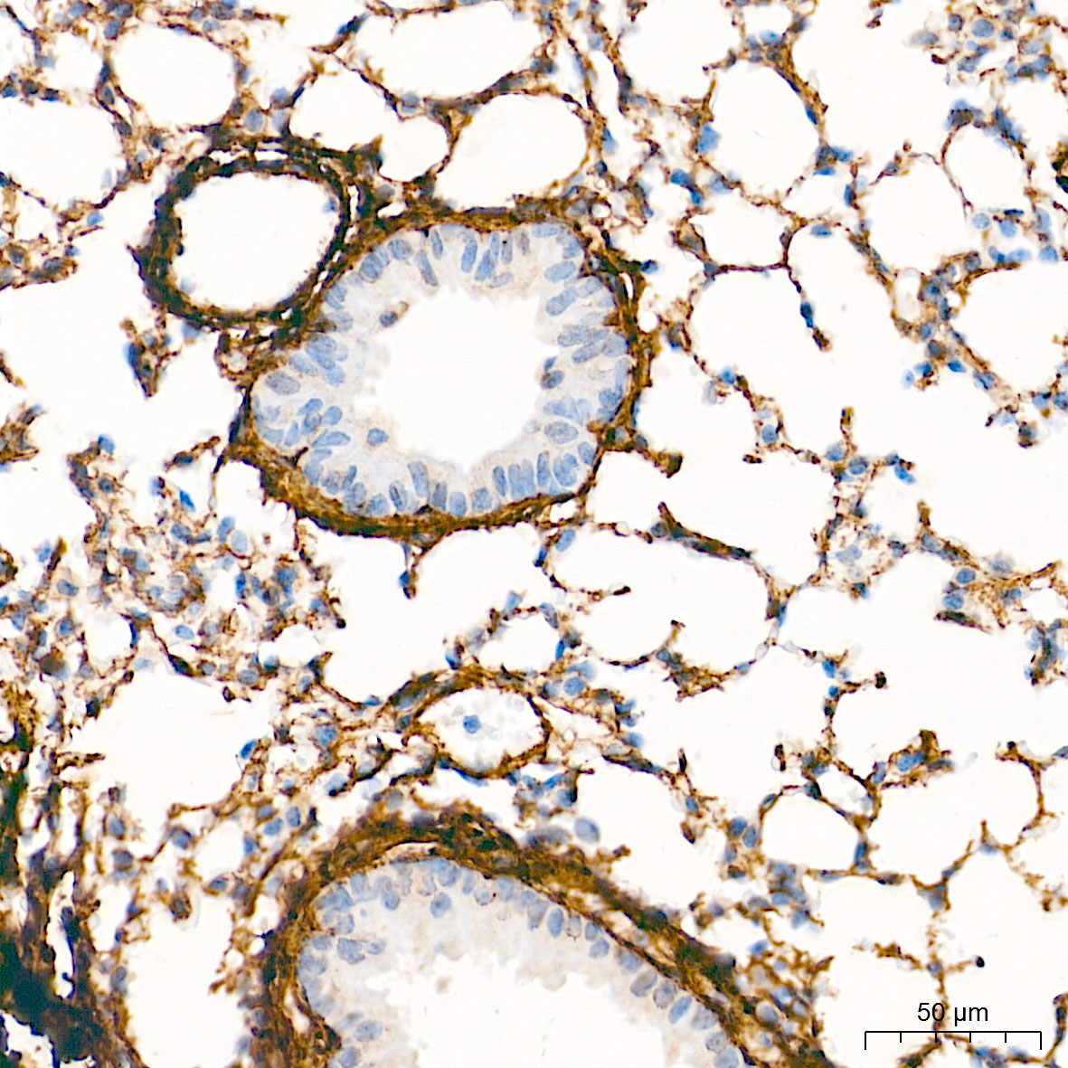 Collagen I/COL1A1 Rabbit Polyclonal Antibody - Image 3