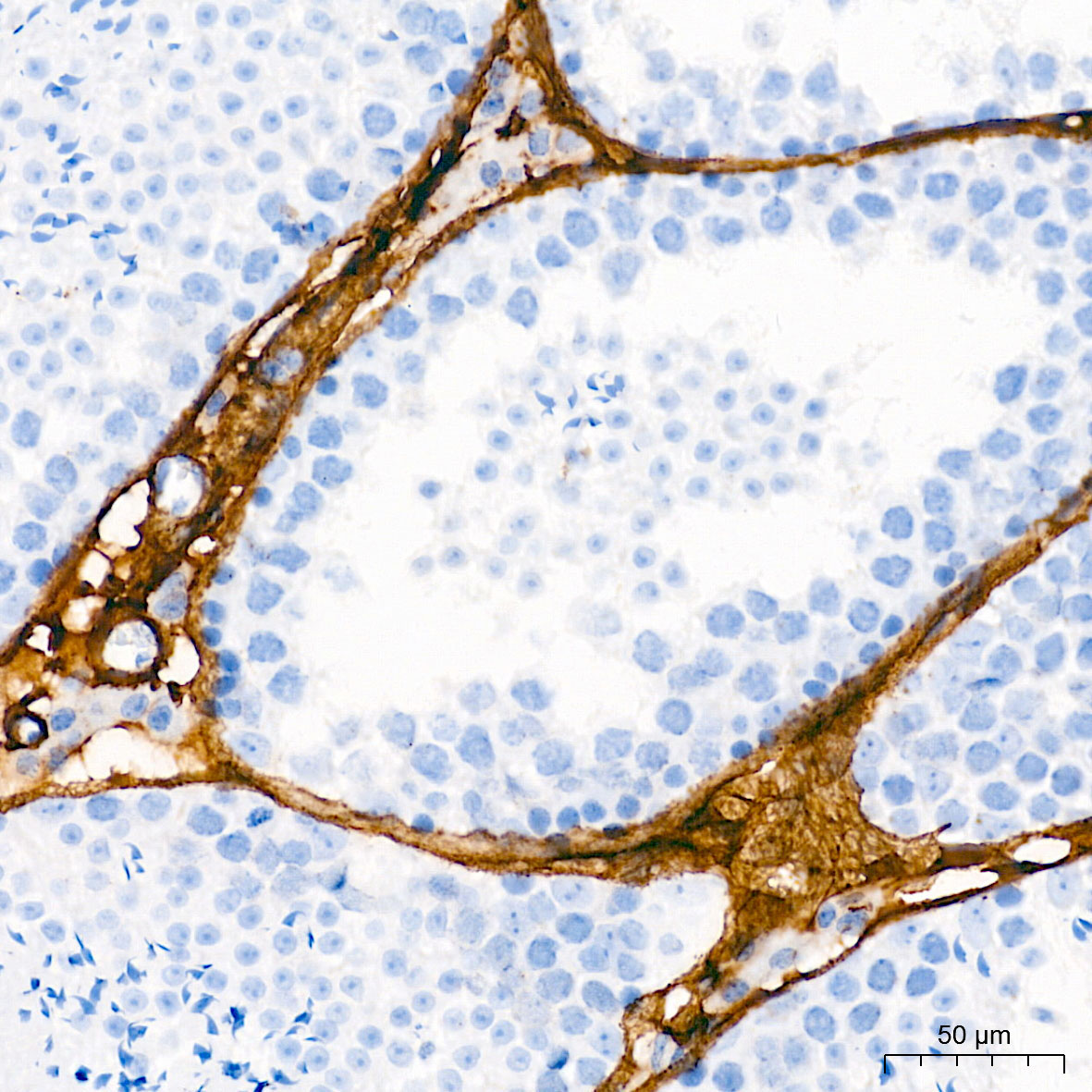 Collagen I/COL1A1 Rabbit Polyclonal Antibody - Image 4