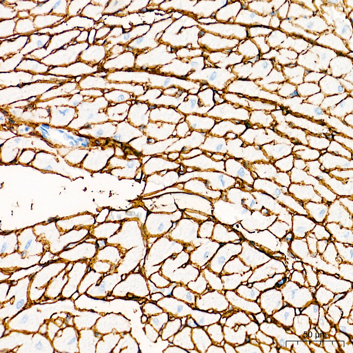 Collagen I/COL1A1 Rabbit Polyclonal Antibody - Image 5