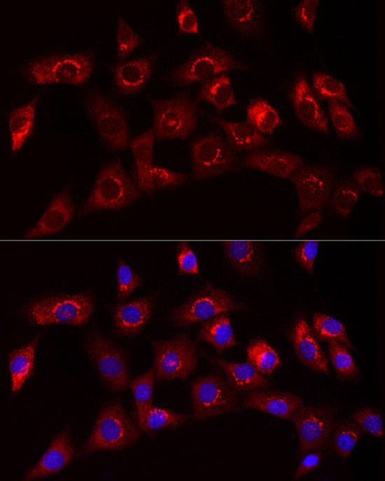 Collagen I/COL1A1 Rabbit Polyclonal Antibody - Image 6