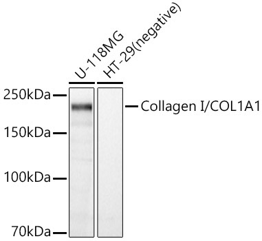 Collagen I/COL1A1 Rabbit Polyclonal Antibody