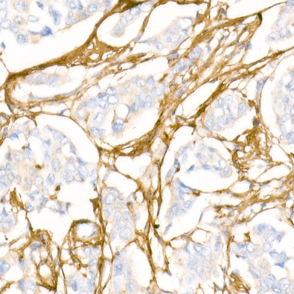 Collagen I/COL1A1 Rabbit Polyclonal Antibody - Image 2