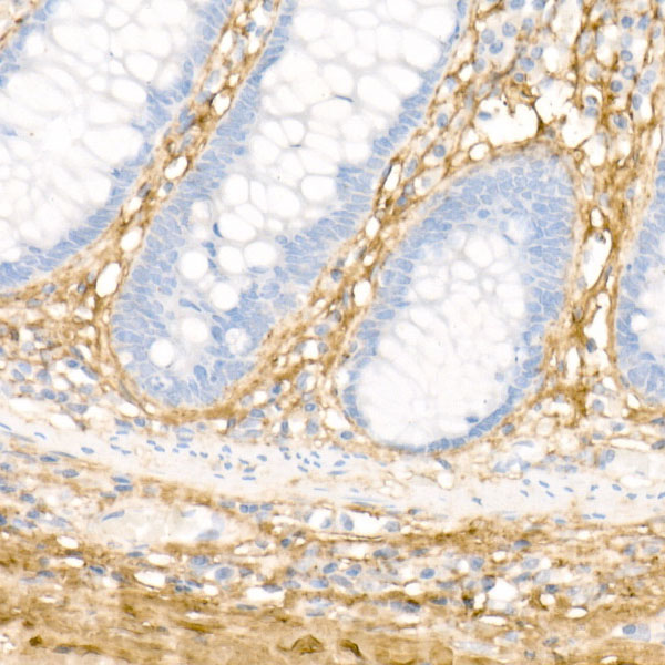 Collagen I/COL1A1 Rabbit Polyclonal Antibody - Image 3