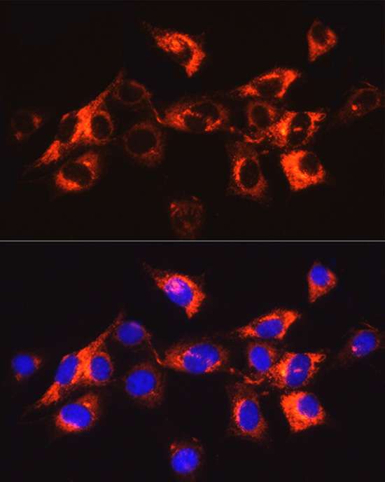 Collagen I/COL1A1 Rabbit Polyclonal Antibody - Image 4