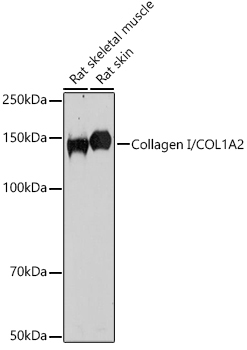 Collagen I/COL1A2 Rabbit Polyclonal Antibody