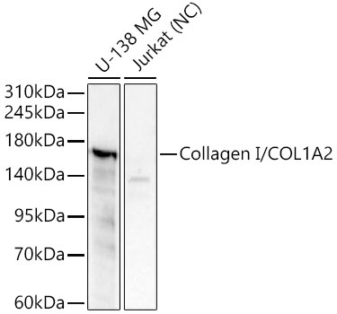 Collagen I/COL1A2 Rabbit Polyclonal Antibody