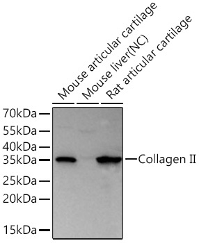 Collagen II Rabbit Polyclonal Antibody