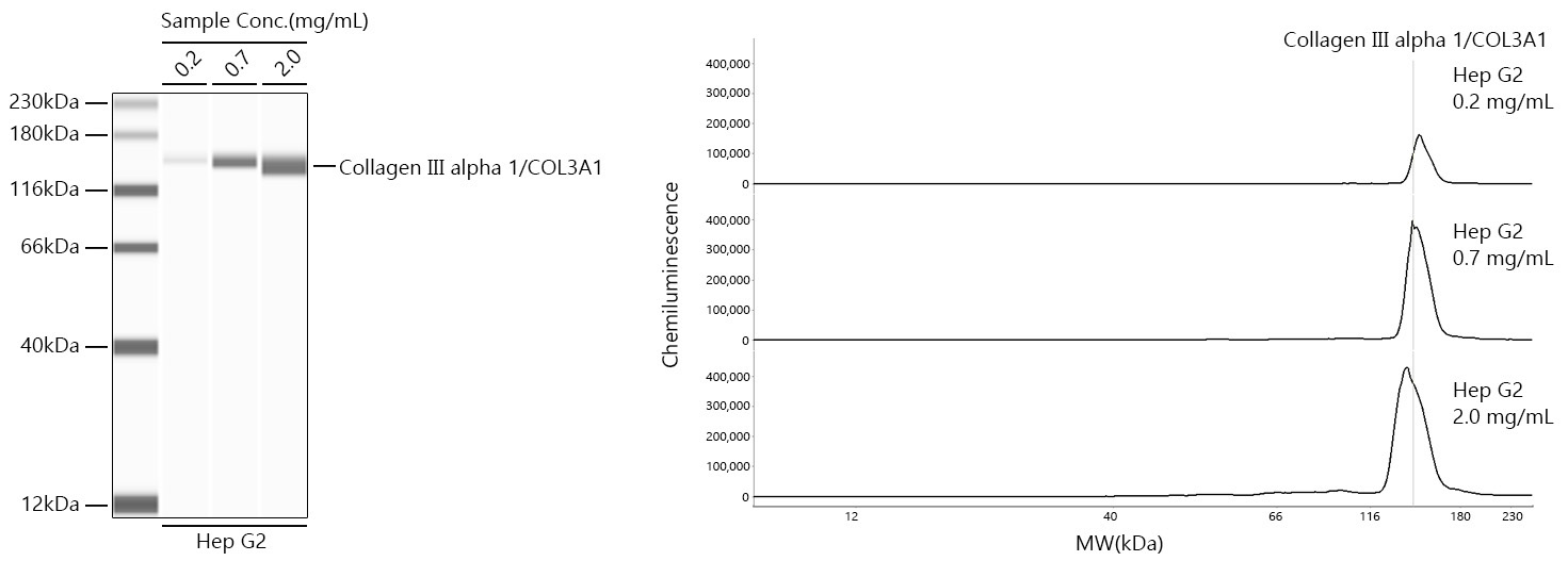 Collagen III alpha 1/COL3A1 Rabbit Monoclonal Antibody