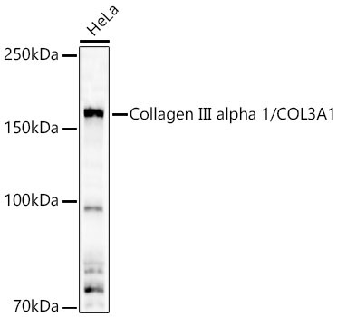 Collagen III alpha 1/COL3A1 Rabbit Polyclonal Antibody