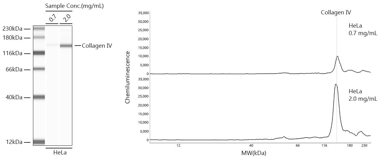 Collagen IV Rabbit Monoclonal Antibody