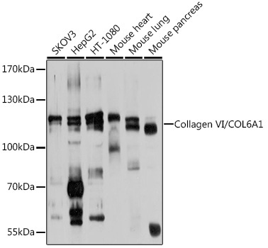 Collagen VI/COL6A1 Rabbit Polyclonal Antibody