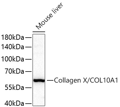 Collagen X/COL10A1 Rabbit Polyclonal Antibody