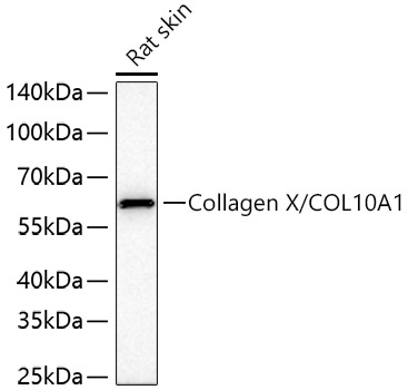 Collagen X/COL10A1 Rabbit Polyclonal Antibody - Image 2