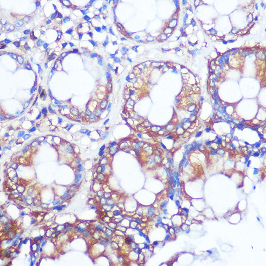 Collagen X/COL10A1 Rabbit Polyclonal Antibody - Image 3