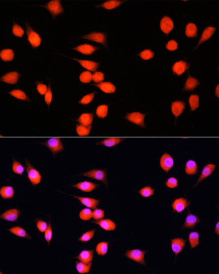 COMMD1 Rabbit Polyclonal Antibody