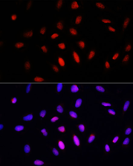 COMMD1 Rabbit Polyclonal Antibody - Image 2