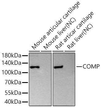 COMP Rabbit Monoclonal Antibody