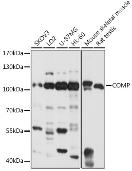 COMP Rabbit Polyclonal Antibody