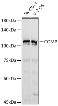 COMP Rabbit Polyclonal Antibody
