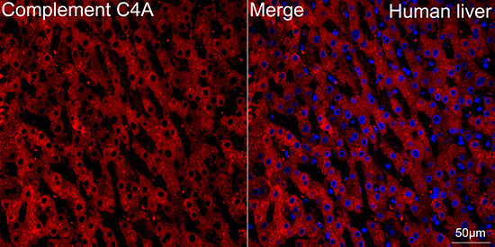 Complement C4A Rabbit Monoclonal Antibody - Image 3