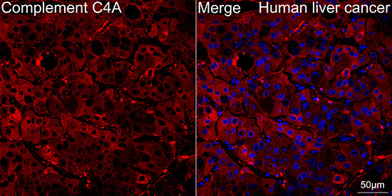 Complement C4A Rabbit Monoclonal Antibody - Image 4