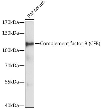 Complement factor B (CFB) Rabbit Polyclonal Antibody