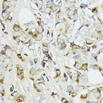 Complement factor B (CFB) Rabbit Polyclonal Antibody - Image 2