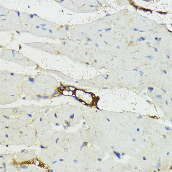 Complement factor B (CFB) Rabbit Polyclonal Antibody - Image 3
